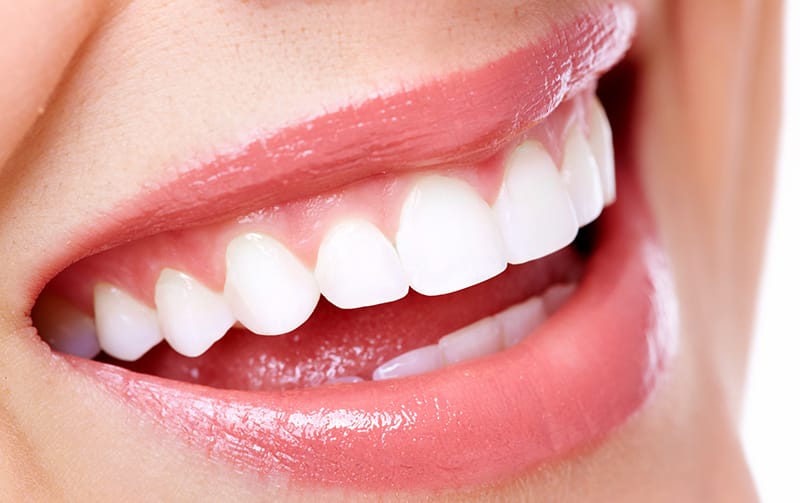 Beautiful woman with dental fillings from Contemporary Dentistry in Rochester, New York