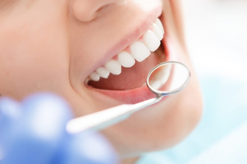 Dental exam showing healthy teeth during a routine checkup