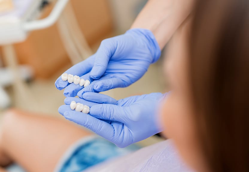 Porcelain Teeth Dentist holding dental crowns to show treatment options