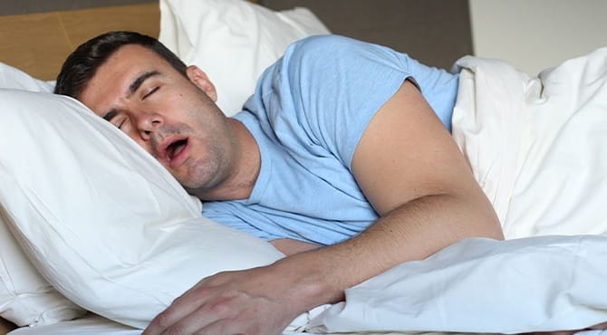 Sleep Apnea Bucket Man sleeping in bed with mouth open representing TMJ and sleep apnea care