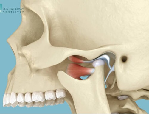 TMJ vs. TMD: Unlocking the Mystery Behind Your Jaw Pain and Finding Relief