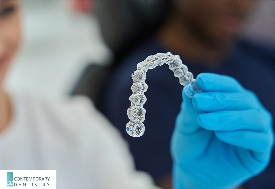 A dentist in blue gloves holds up a clear aligner in a dental office.