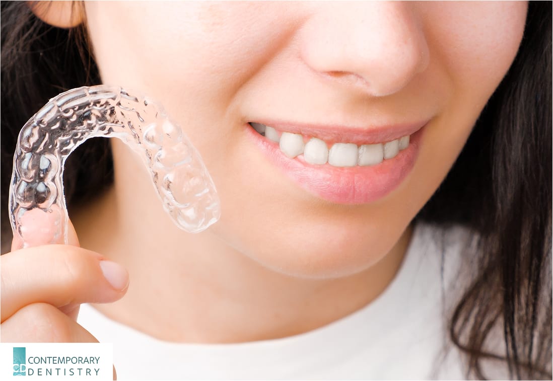 removed invisalign Patient holding clear aligners for teeth straightening