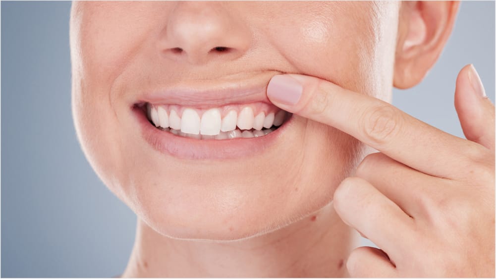 A close-up of a person lifting their lip to show straight white teeth.